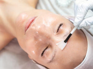 Read more about the article How to Eliminate Fine Lines Naturally: An In-Depth Guide