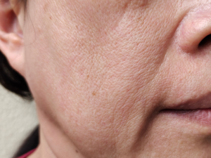 Read more about the article Say Goodbye to Sagging Skin: Natural Tips for a Firmer, Youthful Look
